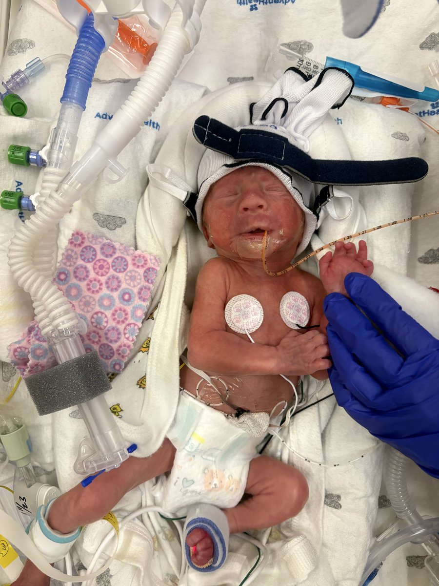 goodkarma_mama's tweet photo. Have not been keeping up on Twitter, but Nova Rain was born on 11/16 at 28 weeks 5 days gestation. She weighed only 2lbs 15oz.
Today was her third day in the NICU.
Thank you for following along & your support in our journey. 🖤
#SuperNova #NICUwarrior #NICUbaby #NovaStrong https://t.co/0lSxaTIRvd