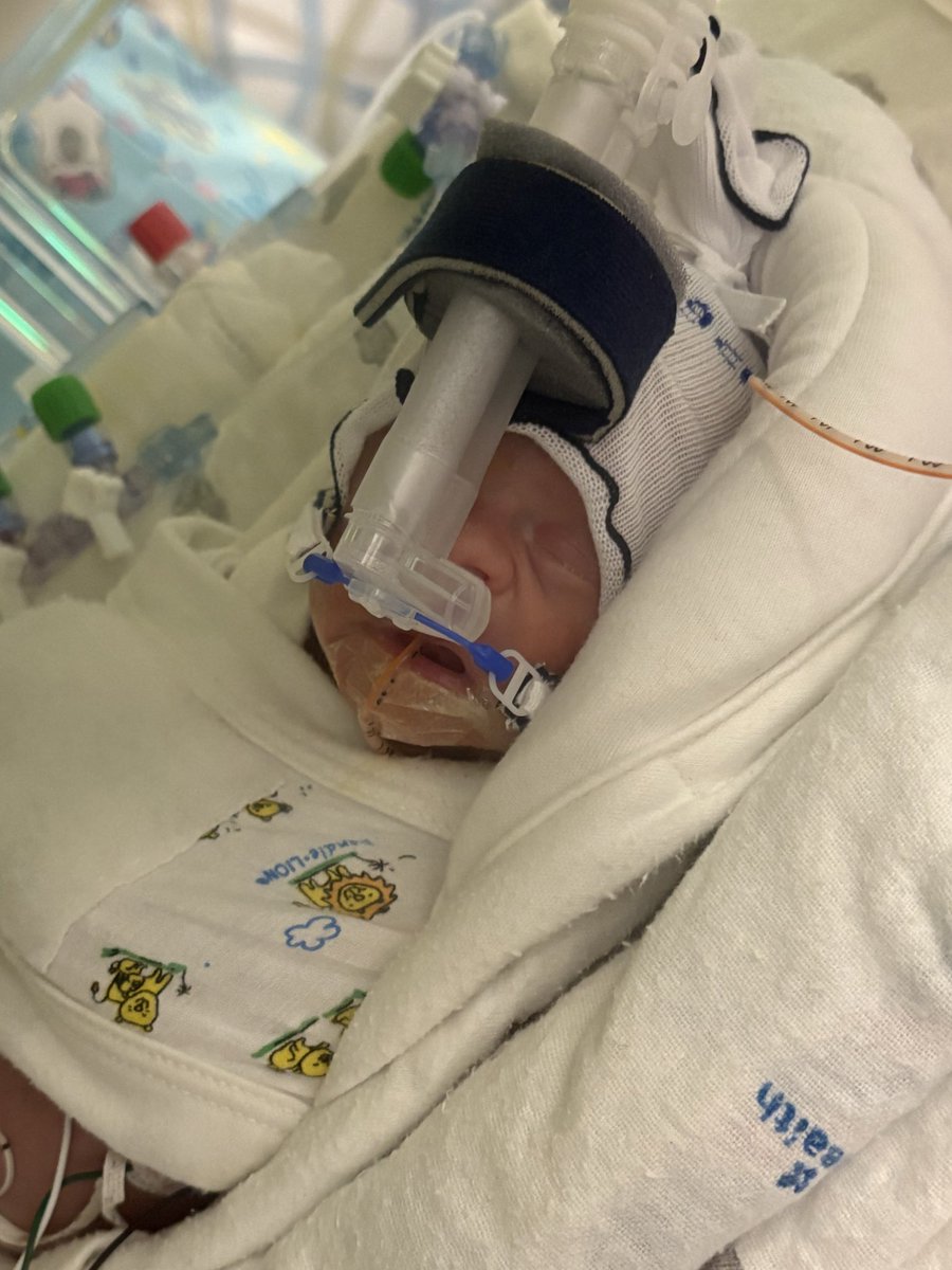 goodkarma_mama's tweet photo. Have not been keeping up on Twitter, but Nova Rain was born on 11/16 at 28 weeks 5 days gestation. She weighed only 2lbs 15oz.
Today was her third day in the NICU.
Thank you for following along & your support in our journey. 🖤
#SuperNova #NICUwarrior #NICUbaby #NovaStrong https://t.co/0lSxaTIRvd