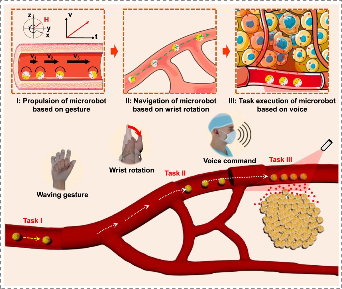 IntJExtremManuf's tweet image. A wearable #AI-driven control system that uses multimodal #sensors and #MagneticActuation to precisely navigate micro/#nanorobots, enabling adaptive real-time manipulation and targeted cancer-cell killing, advancing intelligent #BiomedicalRobotics.

#IJEM: doi.org/10.1088/2631-7…