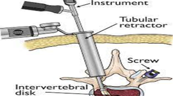SEO_Expert_Andy's tweet image. Understanding Spine Health: When to Seek Professional Help - drsujoysanyal.com/understanding-…

 #MinimallyInvasiveSurgery #spinehealth #spinesurgeon #minimalaccessspine #minimallyinvasivespinesurgery #neurosurgeon #neurosurgery #brainsurgeon #NeuroCare