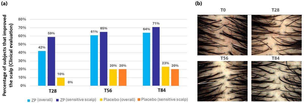 #OpenAccess #Article

📑Title: #Skin and #Scalp Health Benefits of a Specific #Botanical Extract Blend: Results from a Double-Blind #Placebo-Controlled Study in Urban Outdoor Workers 

Authors: Vincenzo Nobile et al.

📌  brnw.ch/21wXFiR