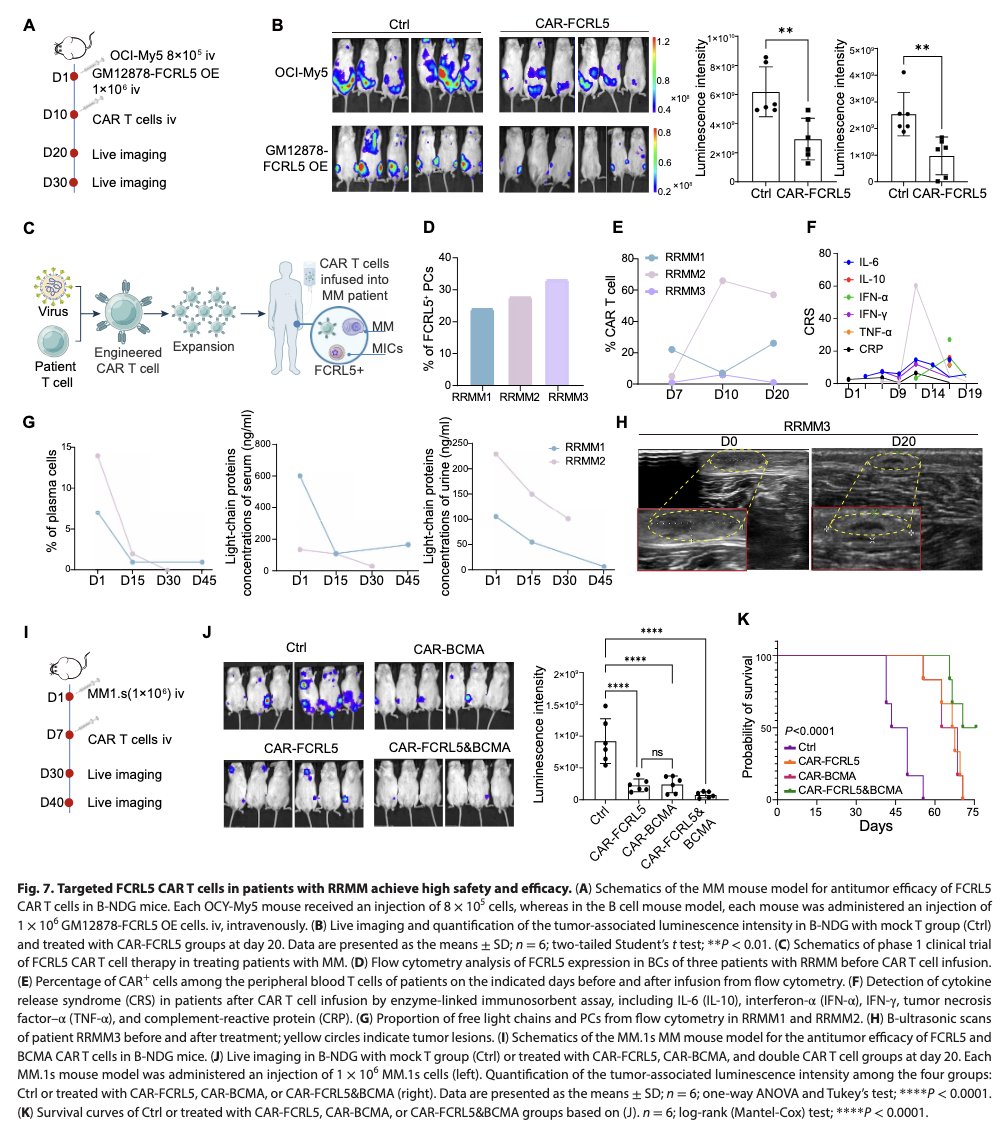 #Myeloma Paper of the Day: Study of malignant transformation in myeloma-initiating cells finds 1qAmp originates from CD24-FCRL5+ B-cells, del 17p occurs at plasma cell stage, &amp; FCRL5 facilitated malignant plasma cells via interaction w/ IRF4/SPI1: pubmed.ncbi.nlm.nih.gov/41259534/. #mmsm