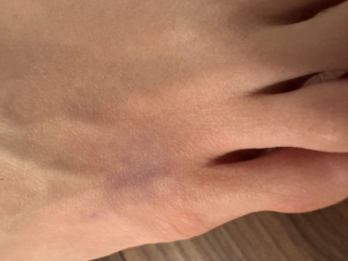 umedango27's tweet image. どこの部位かわかるCA4LA🎩💋？