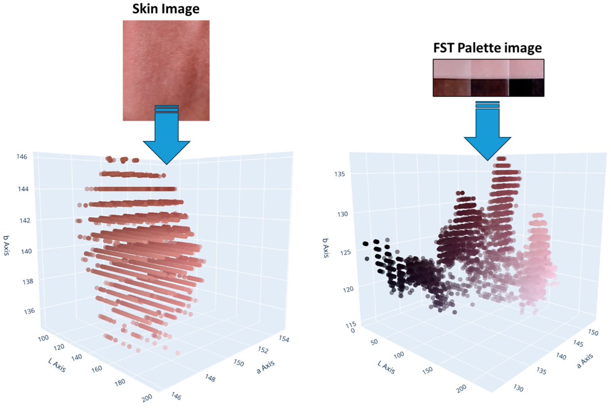 #OpenAccess #Article

📑Title: #AI Dermatochroma Analytica (#AIDA): Smart Technology for Robust #Skin Color Classification and Segmentation 

Authors: Abderrachid Hamrani et al.

📌 brnw.ch/21wXEOY