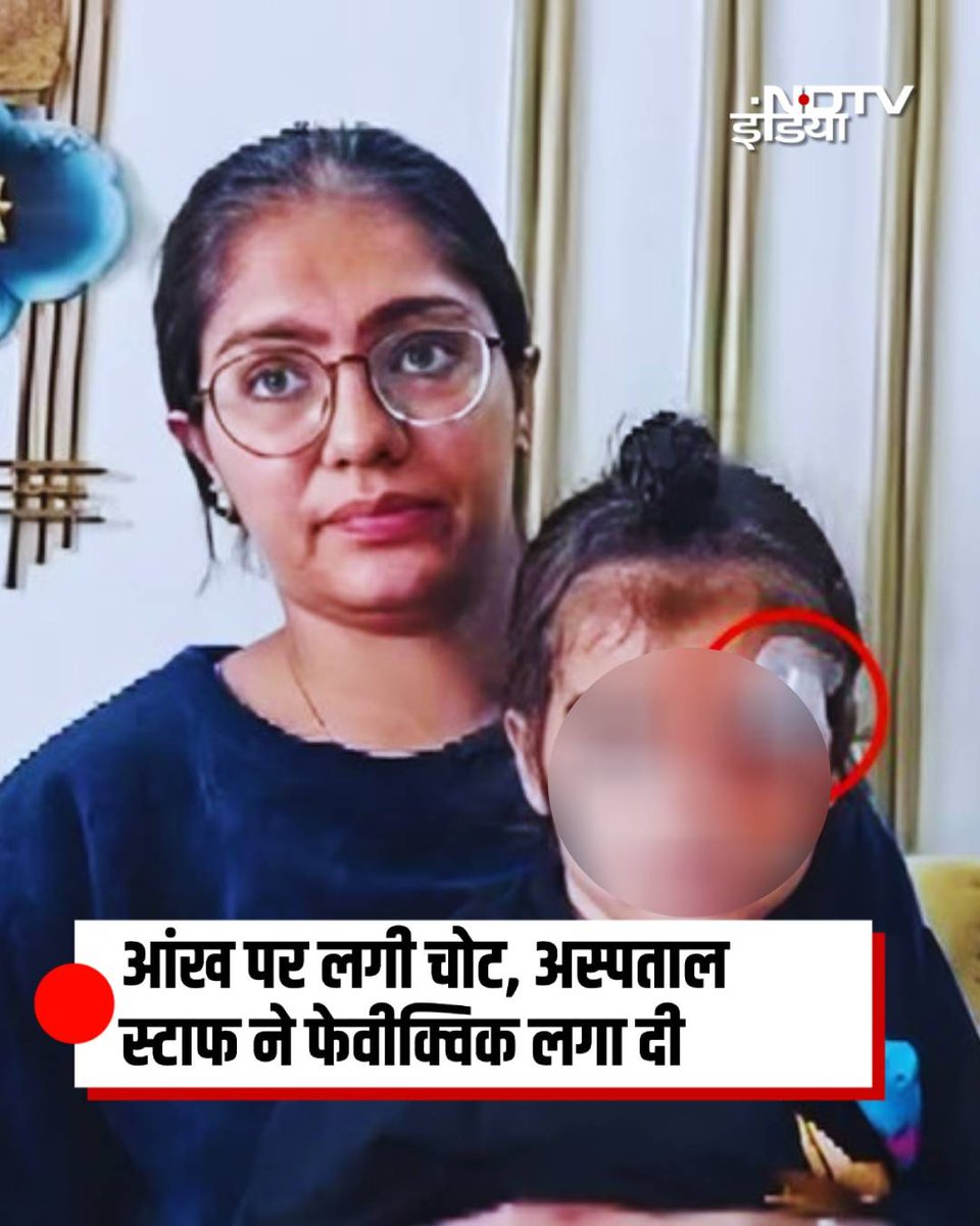 ndtvindia's tweet image. Uttar Pradesh के मेरठ में खेलते वक्त ढाई साल के बच्चे को आंख के पास चोट लग गई. परिवार बच्चे को लेकर एक निजी अस्पताल पहुंचा. जहां अस्पताल की बड़ी लापरवाही देखने को मिली. डॉक्टर ने टांके लगाने के बजाय बच्चे के घाव पर फेविक्विक लगा दी. दर्द बढ़ने पर परिवार बच्चे को दूसरे अस्पताल ले…