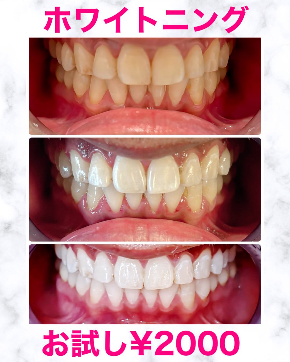 🍭あゆみん👅 (@ayumin1218) / Posts / X