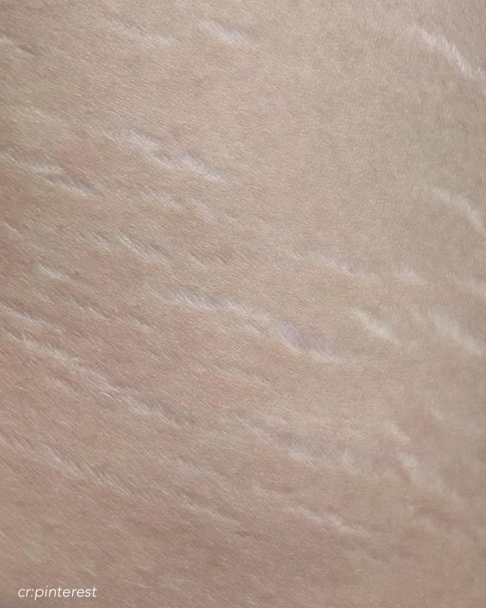 nabsweeft's tweet image. the problem                     the solution