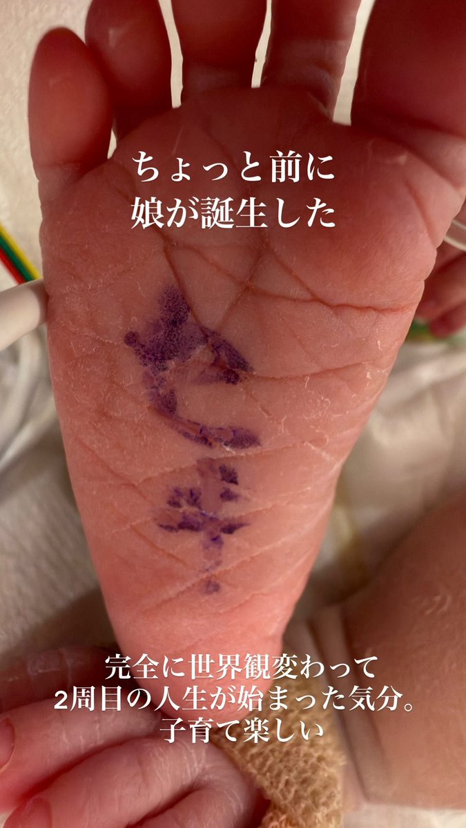 득녀 축하해 세키유😍😍😍😍🎉🎉