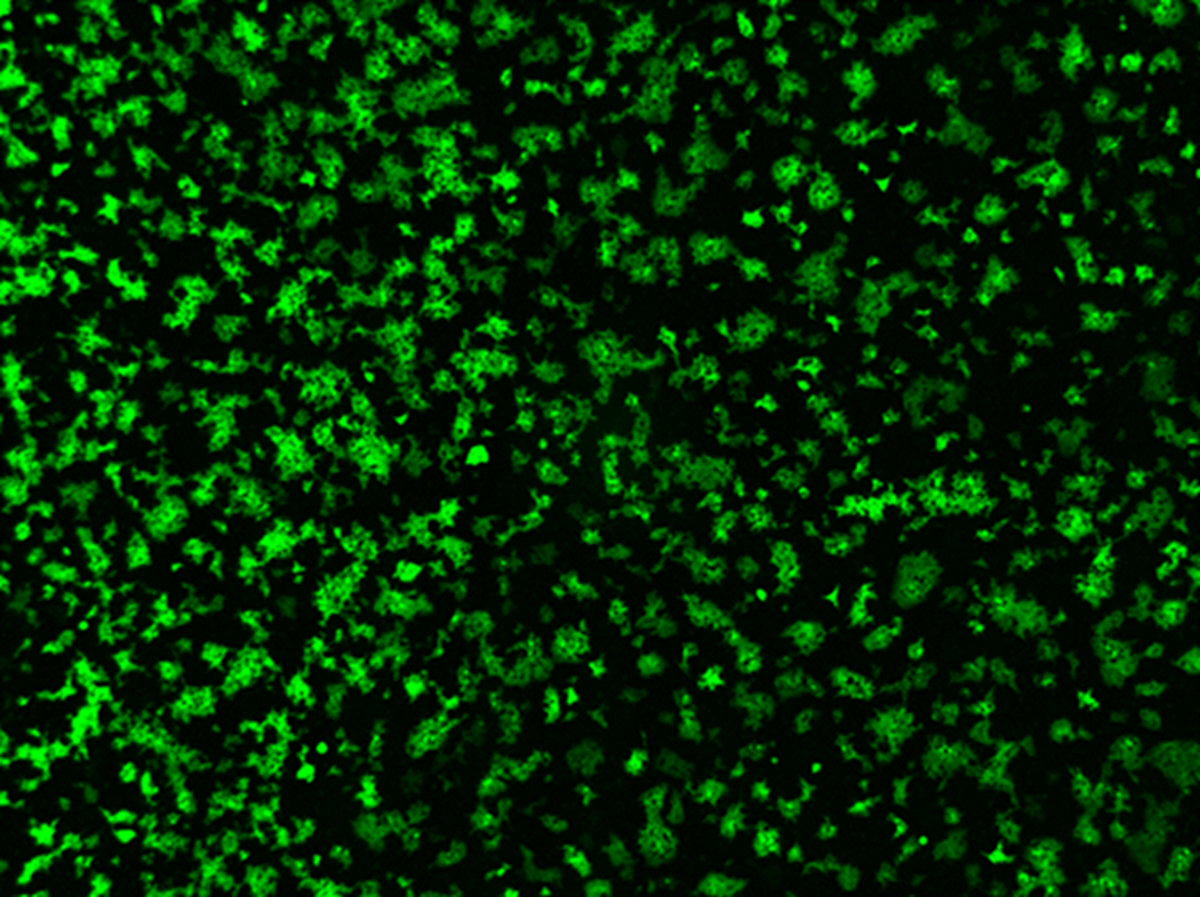 CSIC's tweet image. 🐷 El @i2sysbio descubre que un coronavirus porcino utiliza una vía inesperada para entrar en las células

⚠️ En el laboratorio, este virus porcino usa una proteína de las células humanas para entrar, planteando un posible salto entre especies

➡️ f.mtr.cool/znczxwcuzf