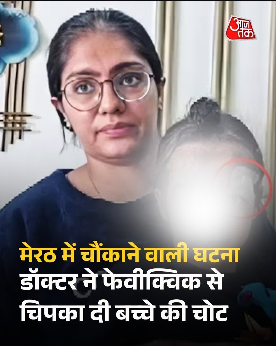 Khurpenchhealth's tweet image. 📍मेरठ में ढाई साल के बच्चे के घाव पर टांके लगाने की जगह डॉक्टर ने फेविक्विक चिपका दी।

ये लापरवाही नहीं , सीधी क्रूरता है।
स्वास्थ्य विभाग बताए—ऐसे डॉक्टर का लाइसेंस अभी तक रद्द क्यों नहीं हुआ?
बच्चे की जान जोखिम में डालने वालों पर कड़ी कार्रवाई कब होगी?