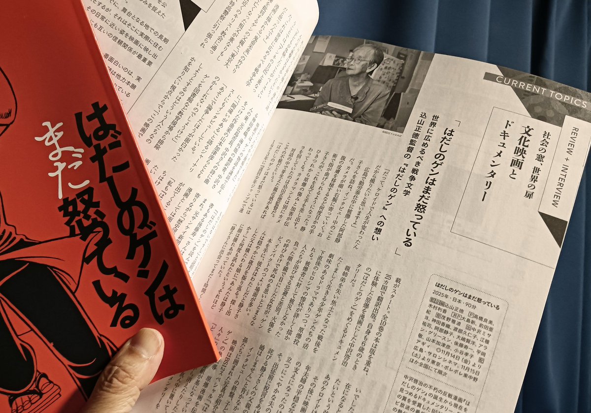 ピカで火傷を負い手術を重ねた腕に監督のカメラがよっていく。中沢啓治