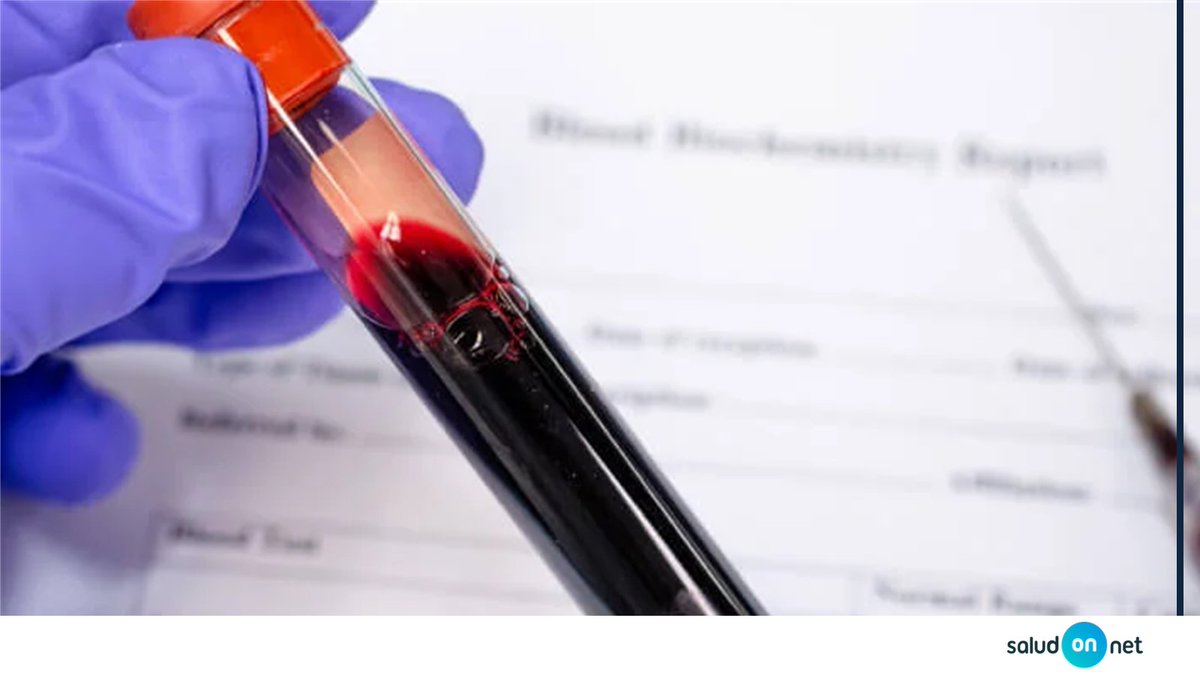 saludonnet's tweet image. Una analítica detecta problemas meses antes de que el cuerpo avise.
Es una de las decisiones preventivas más inteligentes. 🩸