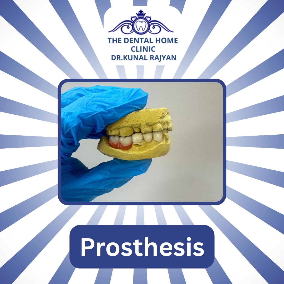TheDentalHomeC1's tweet image. Transforming Smiles, Restoring Confidence! 
Experience life-changing Prosthesis Treatment at Dental Home Clinic — where science meets smile design in every transformation.
📞 +91-7428774577 | +91-9818351814 | 011-46046466
🌐 thedentalhome.in

#PerfectYourSmile #Prosthesis