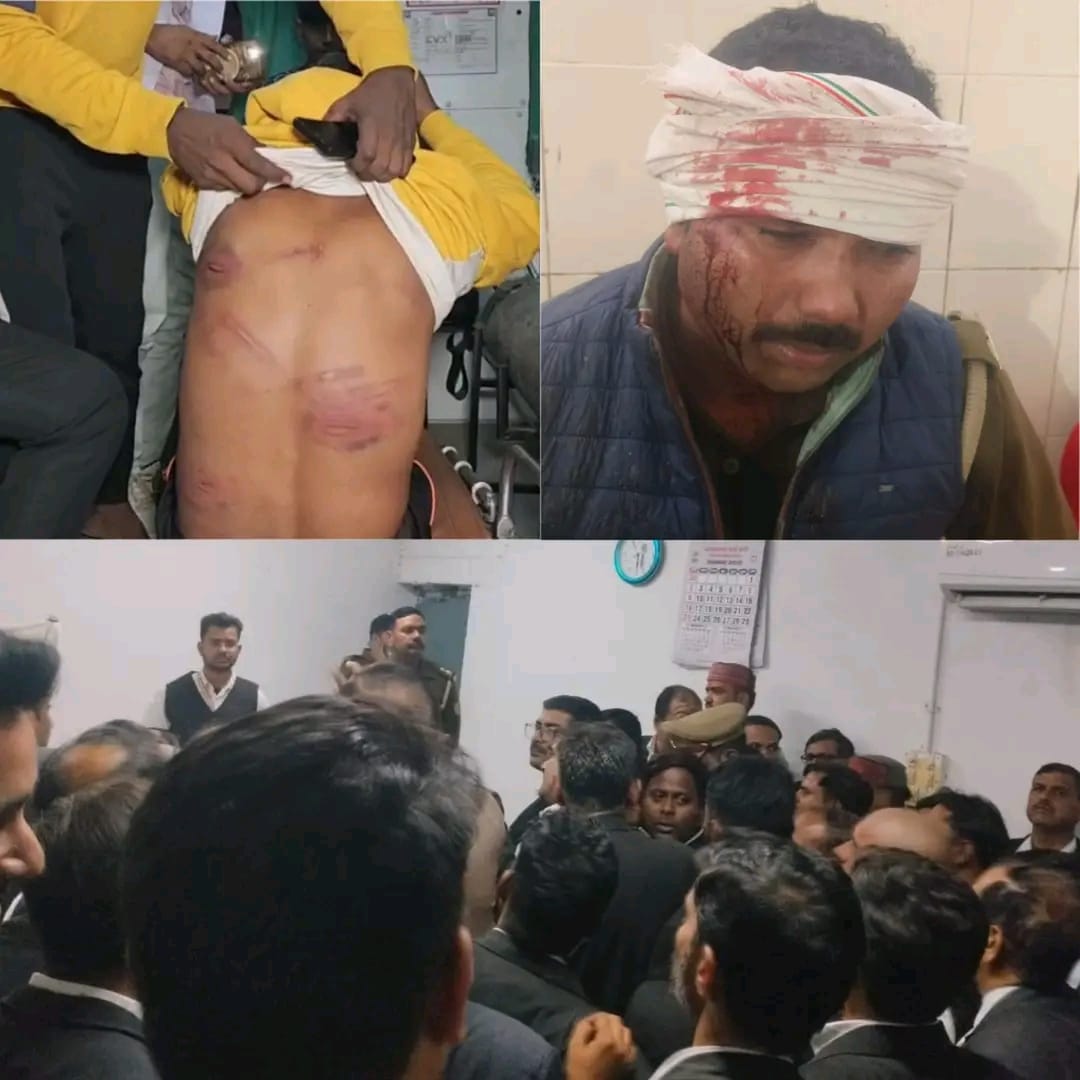 इसे कहते हैं "नहले पे दहला" 

पहले पुलिस ने वकील को थाने में बंद कर जमकर पीटा फिर जैसे ही पुलिस वकील को कोर्ट में पेश करने ले गई तो वहां पर सभी वकीलों ने मिलकर पुलिसकर्मियों को पीट दिया।

कल रात्रि में पुलिस एक 307 के आरोप में एडवोकेट पियूष लोधी को गिरफ्तार कर थाने लाई और थाने