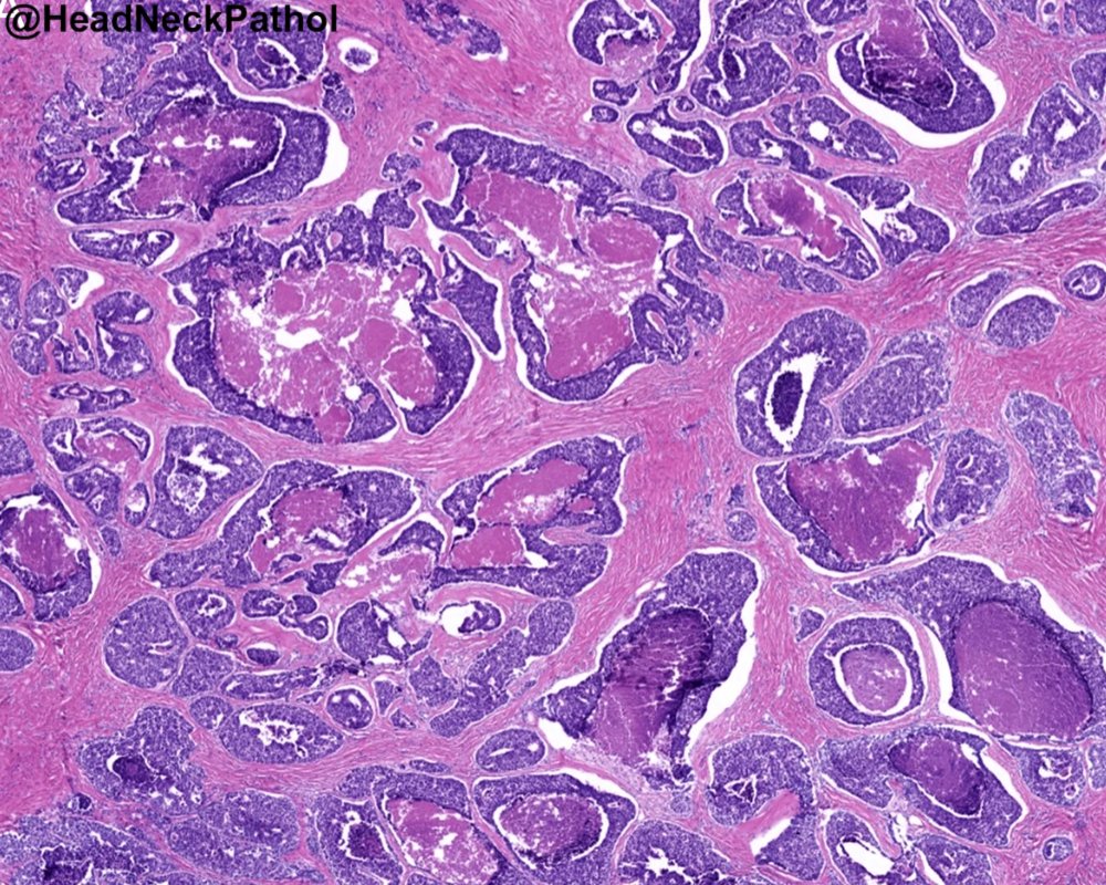 Head Neck Pathol tweet media