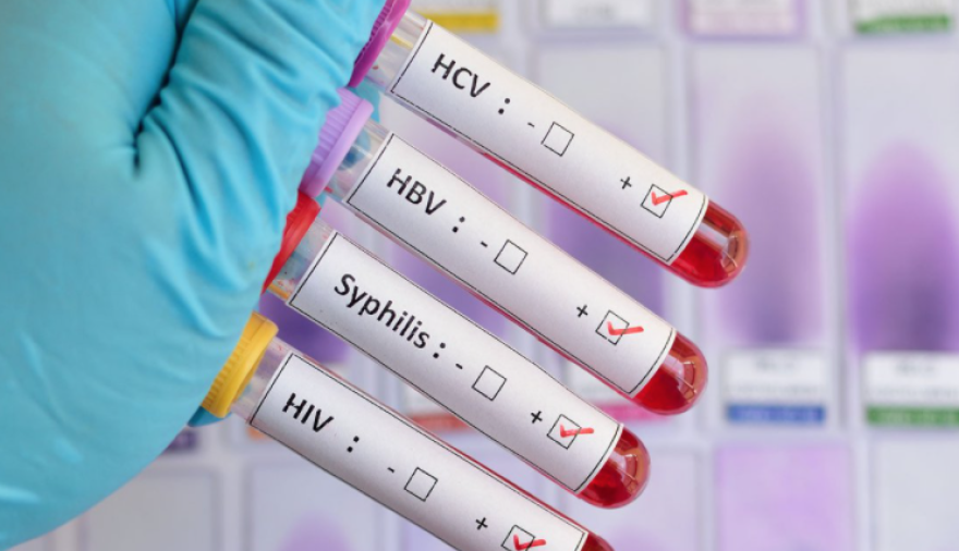 Preocupación sanitaria en la Provincia: crecen la sífilis, la gonorrea y el VIH. n9.cl/nxdh7q