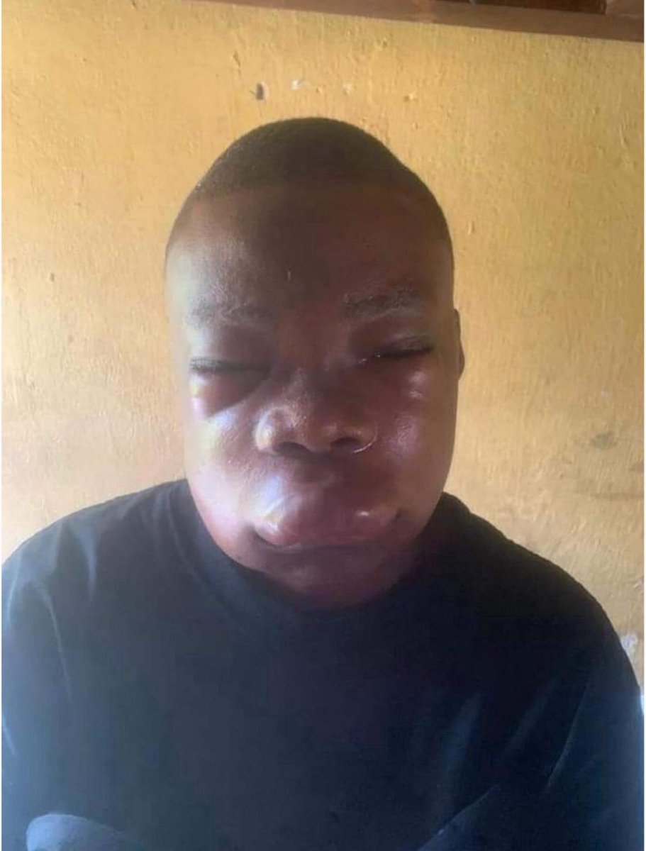 Y4R80D
Oya hold this 3odds Aboli