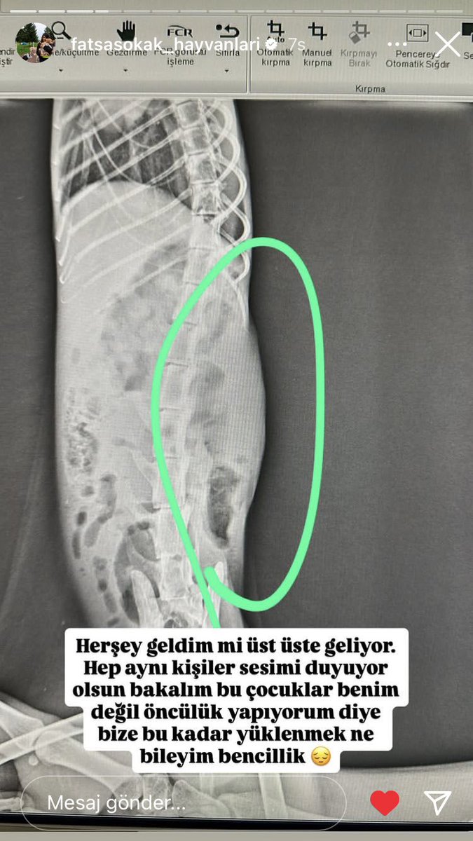 BIZI DE GORUR MUSUNUZ COK ZOR DURUMDA VE TEDAVISI COK MASRAFLI DESTEK OLUR MUSUNUZ 😭🙏🏻