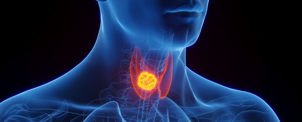 AIBuzzNews's tweet image. BREAKING: Ozempic tied to cancer in millions of patients.

But wait, it could also save lives and prevent cancer.

This new study flips everything.

Here’s what the science actually says.