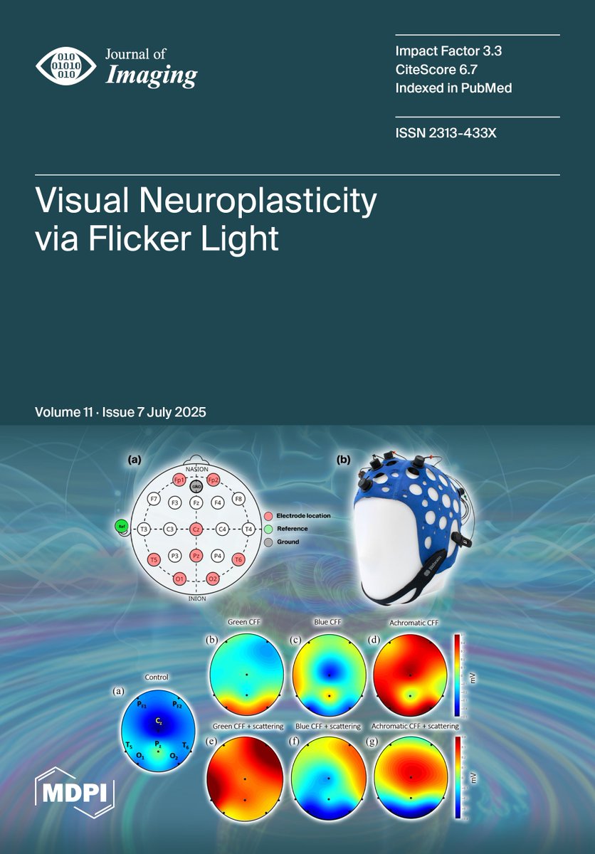 Visual flicker increases beta–gamma activity and introduces a new non-invasive E/I ratio—promising for neurotherapy.

🗒️Visual Neuroplasticity: Modulating Cortical Excitability with Flickering Light Stimulation
🔗mdpi.com/2313-433X/11/7…

#MDPIjimaging #Neuroscience #EEG