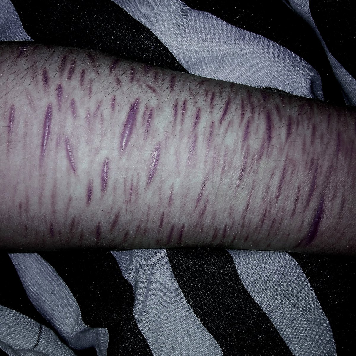 #selfharm