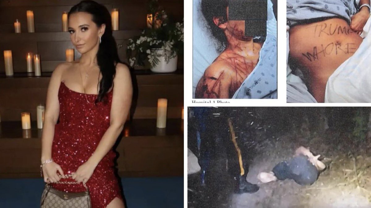 🚨BREAKING: Natalie Greene, GOP Aide, is facing 10 YEARS IN PRISON for allegedly staging her own kidnapping and assault and writing “Trump Whore” on her own body. 

Is she MAGA JUSSIE SMOLLETT? 

EVERYONE POINT AND LAUGH AT THIS CLOWN WITH ME! 

🫵🤡