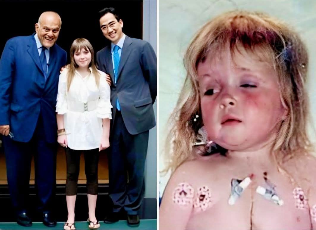 KingMesry's tweet image. الدكتور مجدي يعقوب من حوالى 20 سنة عمل عملية زرع قلب لـ طـ.فلة بريطانية عمرها سنتين اسمها &quot;هنا&quot;
ولسبب ما الدكتور مجدى أحتفظ بالقلب القديم للطفلة داخل جسمها بتكنيك طبى ومكنش معروف السبيب
الطفـ.لة هنا بعد مرور 10 سنين من العملية بدأت تظهر عليها أعراض كانسر الدم وبعد الفحوصات