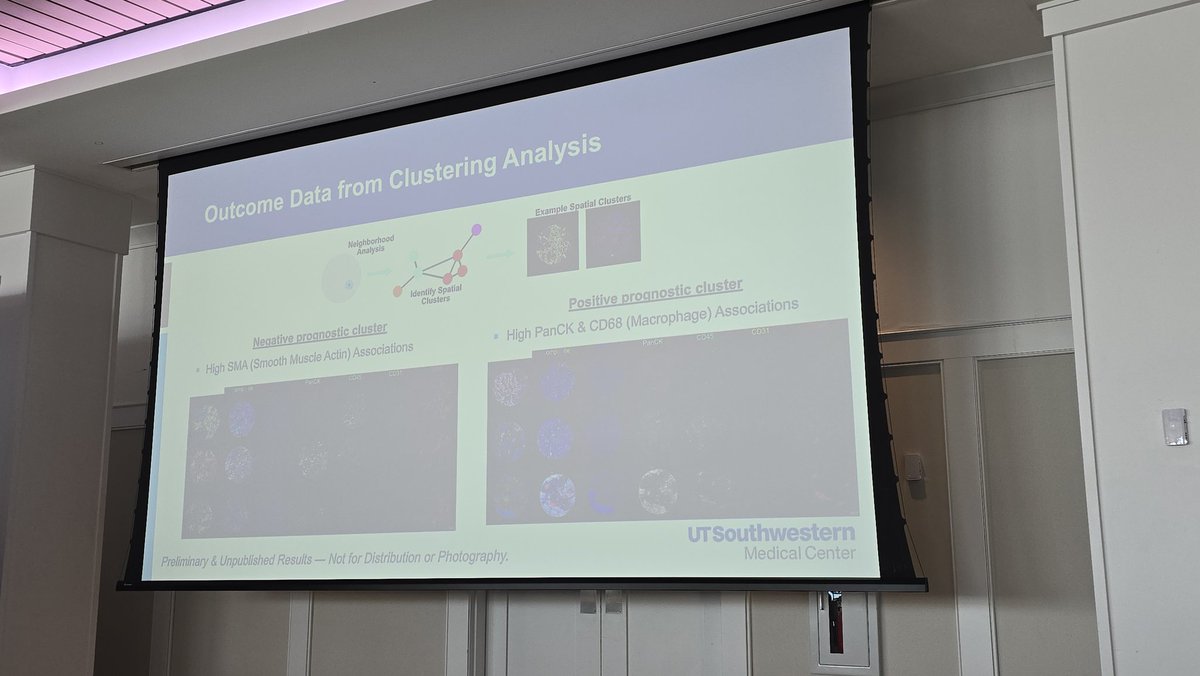 QianJanieQin's tweet image. DR. @JVentoMD giving a wonderful talk on his work leveraging #spatial #proteomics to study the tumor microenvironment of #papillary #RCC at #GUSUMMIT25