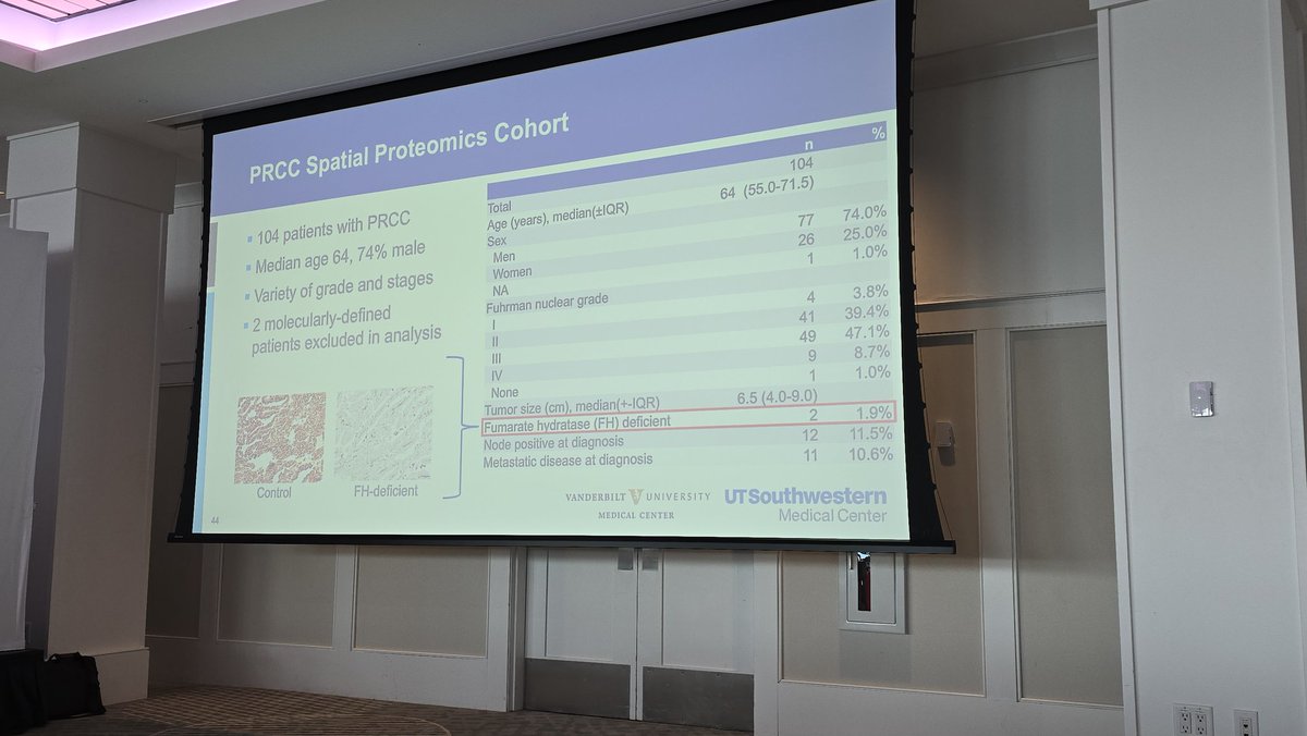 QianJanieQin's tweet image. DR. @JVentoMD giving a wonderful talk on his work leveraging #spatial #proteomics to study the tumor microenvironment of #papillary #RCC at #GUSUMMIT25