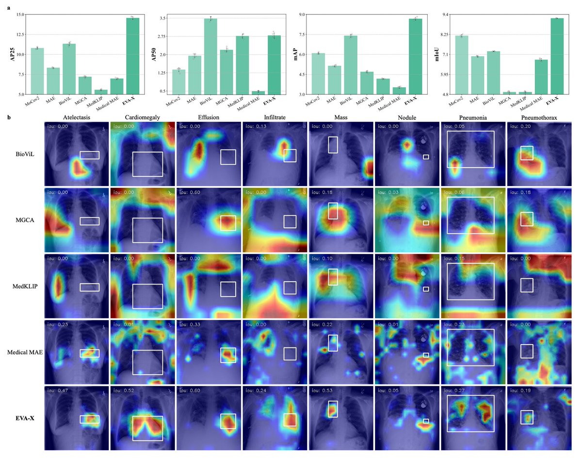 Tiny Models, Massive Capacity, Zero Labels — this is the future of health AI!!

Thrilled to share that our paper-- EVA-X: a foundation model for general chest X-ray analysis with self-supervised learning, is now published in <a href="/Nature_NPJ/">npj Journals</a>!

In collaboration with <a href="/XinggangWang/">Xinggang Wang</a>’s