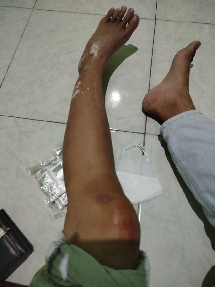 Megaa_aprll's tweet photo. akhir februari dapet teguran banget gatau harus gimana gabisa rasain sakit wkwk kaki sebelah kiri ruduk dada sebelah kanan nyeri gabisa ngeluh ke orang rumah takut bikin khawatir wkwk https://t.co/WQo15VrqAQ