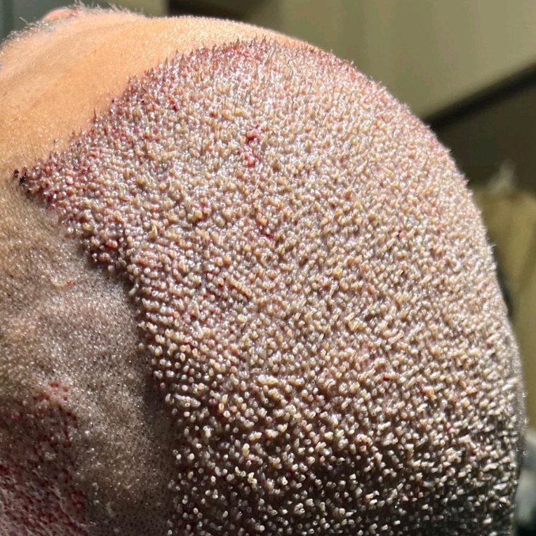 kashtmolabkhand's tweet image. دیروز یکی از متخصصین محترم پوست مو از شیراز بیمارم بود. واقعا ارزشمند بود برام اعتمادش و یک کار عالی براش انجام دادیم.