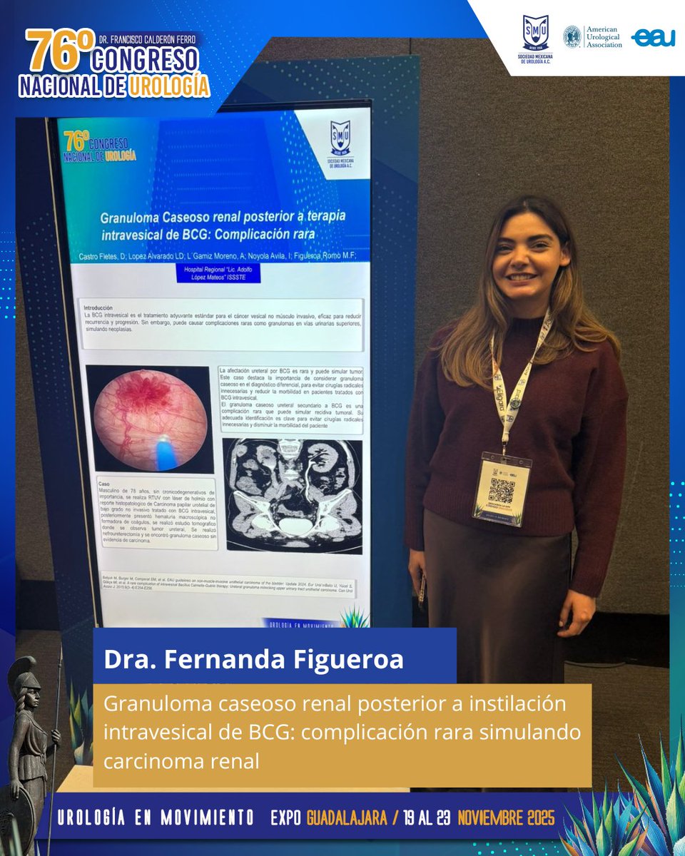 smumexico's tweet photo. Increíble trabajo de nuestros #ResidentesSMU durante la presentación de Trabajos Libres, categoría de Carteles, en el marco del 76° Congreso Nacional de Urología. 📄👏 #SMU25 #UrologíaEnMovimiento

@fernandafigr https://t.co/2sDiGKe29K