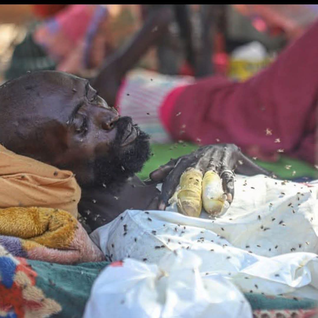 تحركوا لنجدة أهل السودان، يبدوا أن قوة الفزعة تراجعت، قال بعض السودانيين إن هذه ..الصورة مِن  منطقة كورما بولاية شمال  دارفور، أين هي المنظمات الإنسانية والصحية 
العالمية ؟!
أين هي الجمعيات الاسلامية العالمية؟