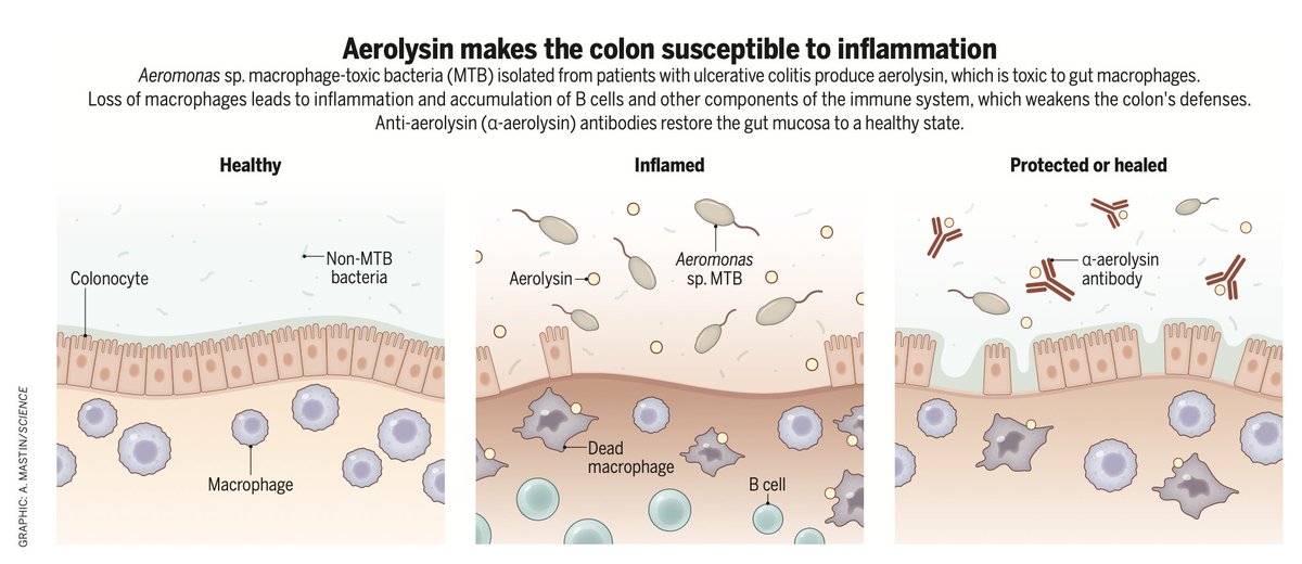 EricTopol's tweet image. New discovery in ulcerative colitis: a bacterial toxin that kills macrophages and increases inflammation, which could be the foundation for a new treatment
science.org/doi/10.1126/sc…
science.org/doi/10.1126/sc…
@ScienceMagazine
