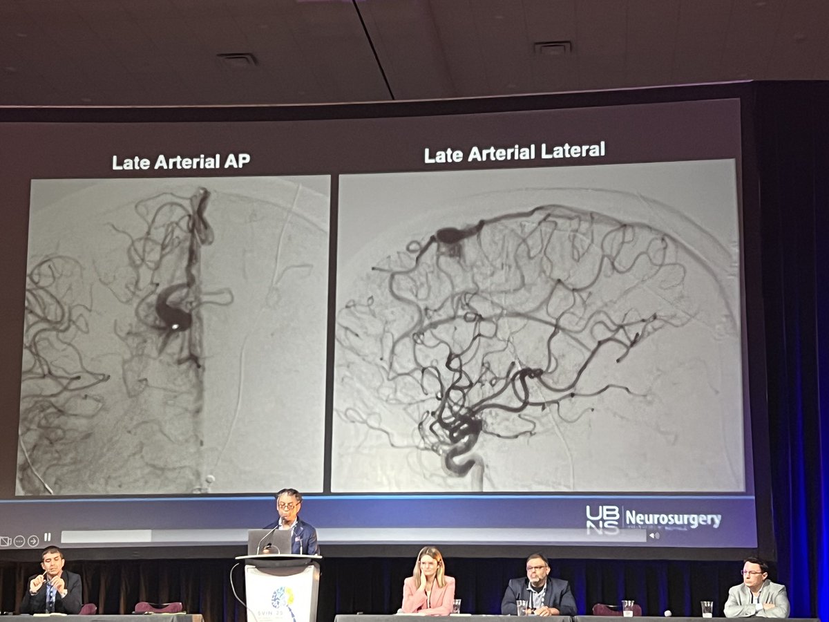 🚨Updates on AVMs🚨

Breaking down the newest data and endovascular nuances at “Updates on AVMs” — happening now in Grand Caribbean 6–7.

#SVIN25 <a href="/svinsociety/">SVIN</a> <a href="/SVINJournal/">Stroke: Vascular and Interventional Neurology</a> <a href="/YoungNIR/">YoungNIR</a> <a href="/ESOstroke/">European Stroke Org</a> <a href="/MThrombectomy/">Mission Thrombectomy</a> <a href="/WomenInNeuroIR/">WINN 🇺🇦</a> <a href="/StrokeAHA_ASA/">Stroke AHA/ASA</a>