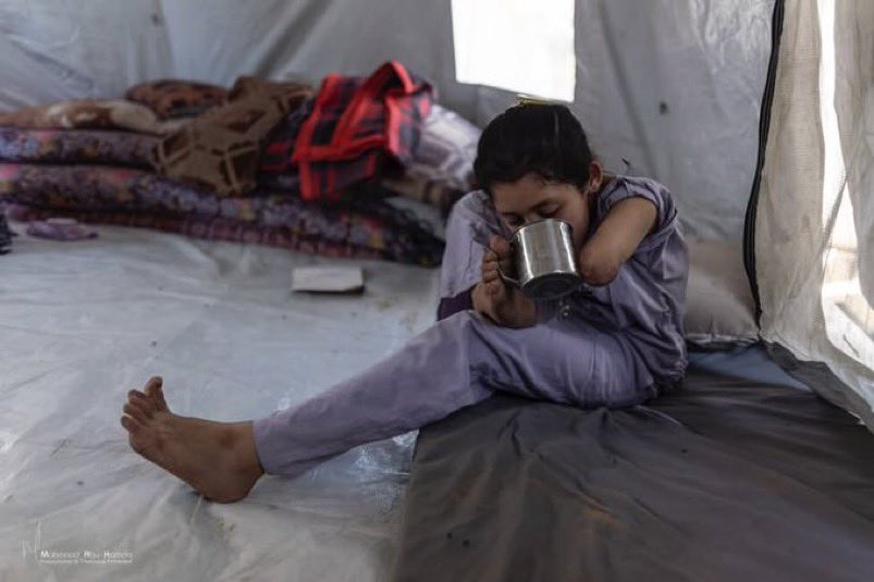 Abu_Salah9's tweet image. تقتلني هذه الصور،

بسبب جندي مجرم أراد التسلية، تعيش هذه الطفلة مأساة ابدية.