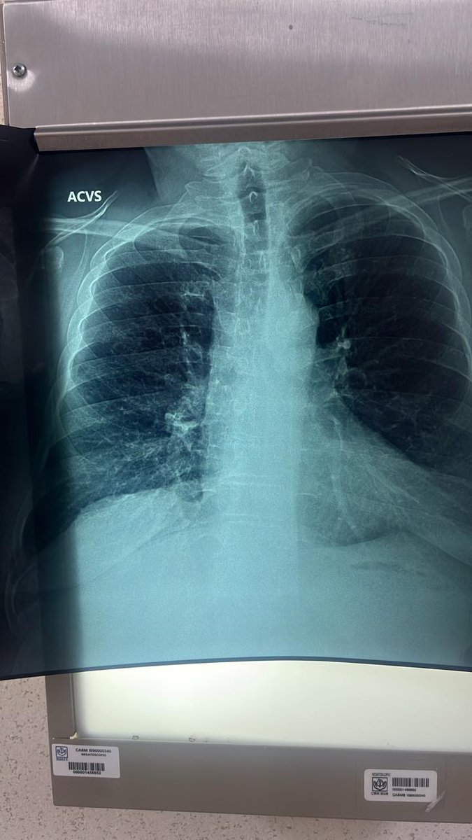 Issste_BCS's tweet image. 📰 #COMUNICADO
Llama ISSSTE a evitar el consumo de tabaco para prevenir la EPOC.
🔗goo.su/S7kzU