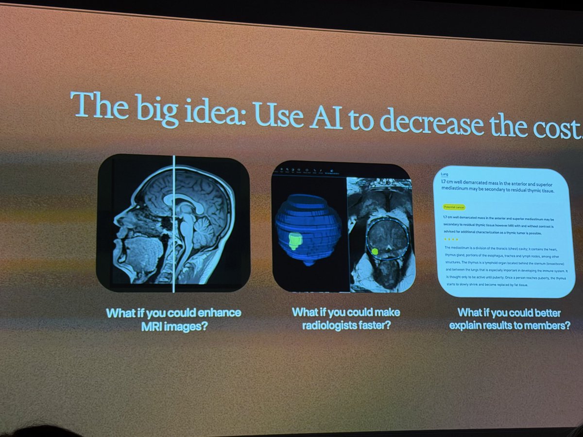 Odile_Roujol's tweet image. Hi 👋 @emigal . Great experience with the MRI ( LA Beverly). Looking forward to see my result on @function platform. Love the pajama! #earlydetection #health will recommend the scans to my beloved !