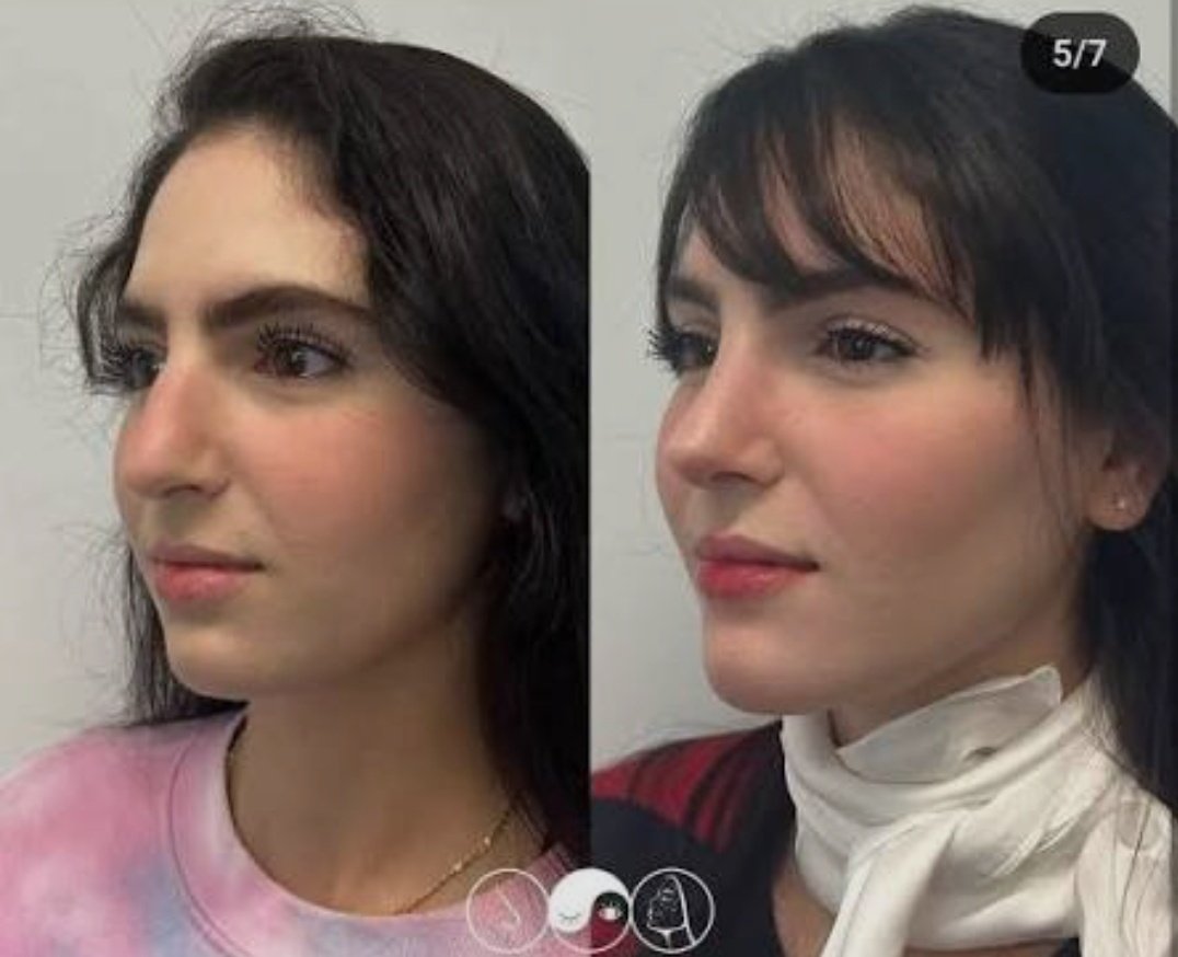 esterma8762's tweet image. Ahi tienen a miss venezuela y miss mexico antes de operarse. Cachen!!! #InnaMoll es bella naturalmente. Que injusticia!!! Miss Universo un robo descarado. INNA MERECIA ESTAR EN LOS TOP 5. 
#MissUniverse