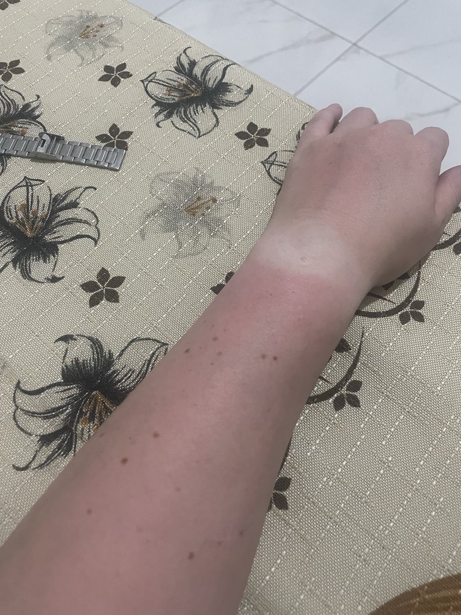 Dirigir nesse calor de rp não é fácil