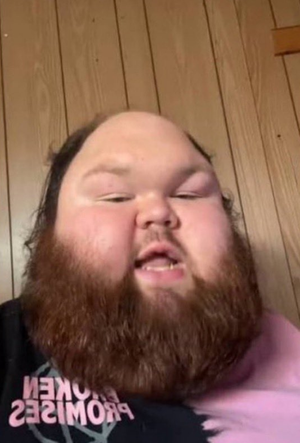 so thats what it would look like if a testicle and a thumb combined