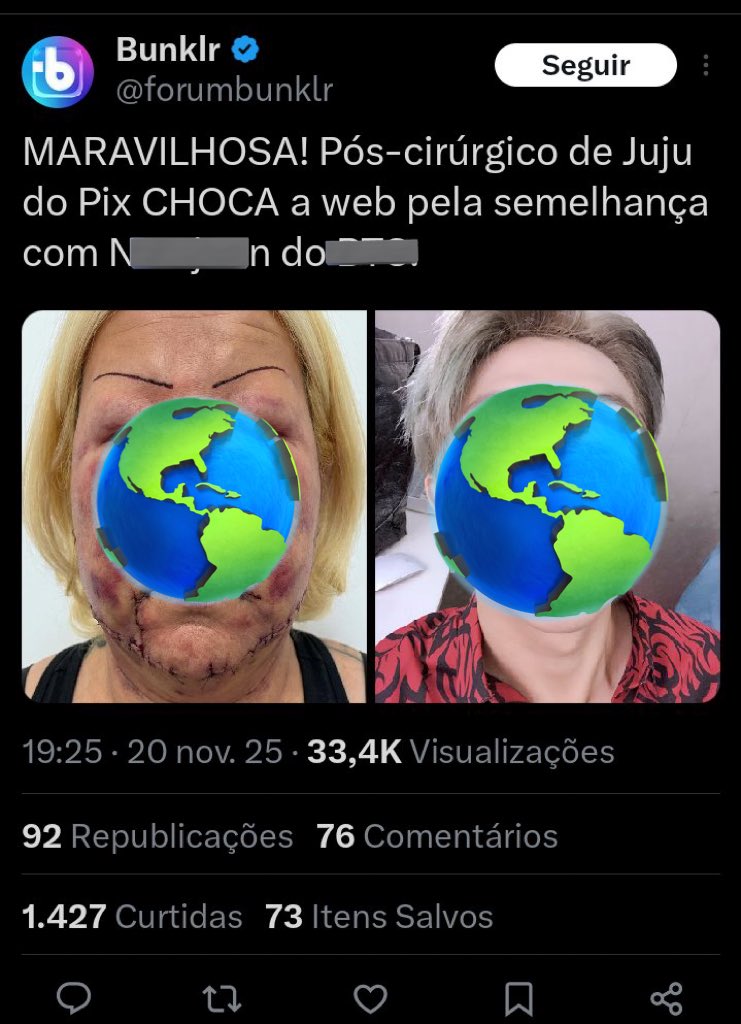 AzulindigoRM's tweet image. 🚨DENUNCIEM SEM ENGAJAR

Esse tipo de página vive atacando os meninos. O 🐨 está sendo atacado gratuitamente e NÃO VAMOS ACEITAR.

🔗x.com/forumbunklr?s=…

A conta apagou após viral de hate, mas aqui está a prova para vocês não se esquecerem. Façam o mínimo por ele, DENUNCIEM!