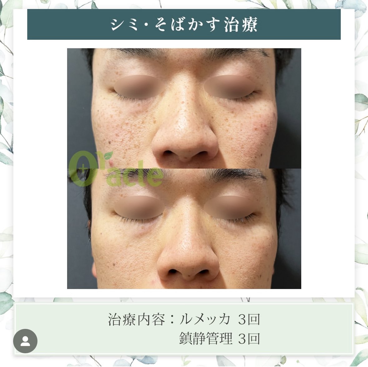 オラクル美容皮膚科【公式】 (@oracleclinic) / Posts / X
