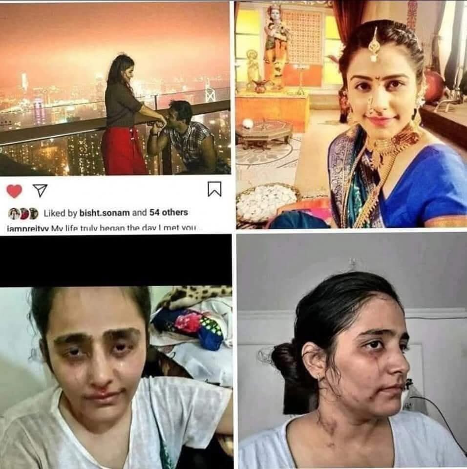 ramesingh's tweet image. #प्रीति_तलरेजा
#टीवी_एक्ट्रेस है
अपने #हिंदू पति को नासमझ, मूर्ख व #पुरानी_विचारधारा का बताते हुए उसे तलाक दिया

फिर #मुस्लिम से शादी करली ताकि ये #स्वच्छंदता  #आजादी का पूरा लुफ्त ले सके

3साल मेही ब्याज समेत पूरा सुख बिना डिस्काउंट मिलने लगा
देखिए सुख से पूरी तरह सूजी पड़ी है😁