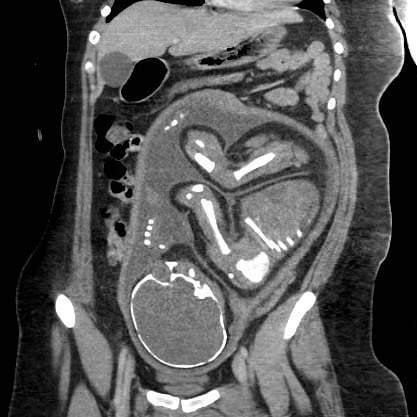 Keith Siau tweet media