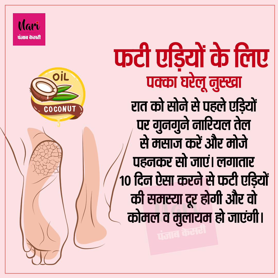 NariKesari's tweet image. एड़ियां फटी हैं? सिर्फ ये नुस्खा अपनाओ

#फटीएड़ियां #HomeRemedy #HealthyFeet #CrackedHeels #DesiNuskha #AyurvedaTips #NaturalCare #SkinCareHindi #HeelTreatment #BeautyTipsHindi #ViralPost #TrendingReel #HealthCare