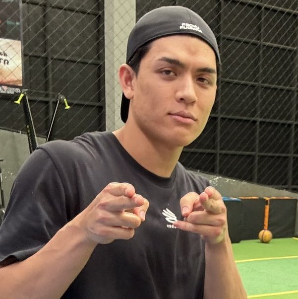 guinzlyx's tweet image. Mel, kejedot apa gimana sih jidat nye?? apa salah liat gw