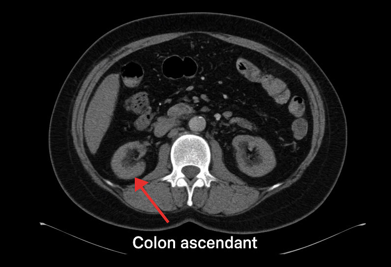 Christophe COUVREUR tweet media