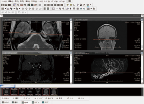 pOszsEapWCyfMD1's tweet image. #チョコザップ のmini人間ドックに行ってきた～🧠
ホントにお手軽
そーいえば近くまで行くな…と思い立って当日に予約して、事前の問診（Web）に登録

脳MRI検査はスルっと15分くらいで終わる
現地で問診することもなく
何か詮索されることもなく
MRIに入ってただ撮ってもらうだけ
まさに #chocoZAP…